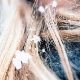 Aprenda a hidratar o cabelo no inverno e fuja do frizz