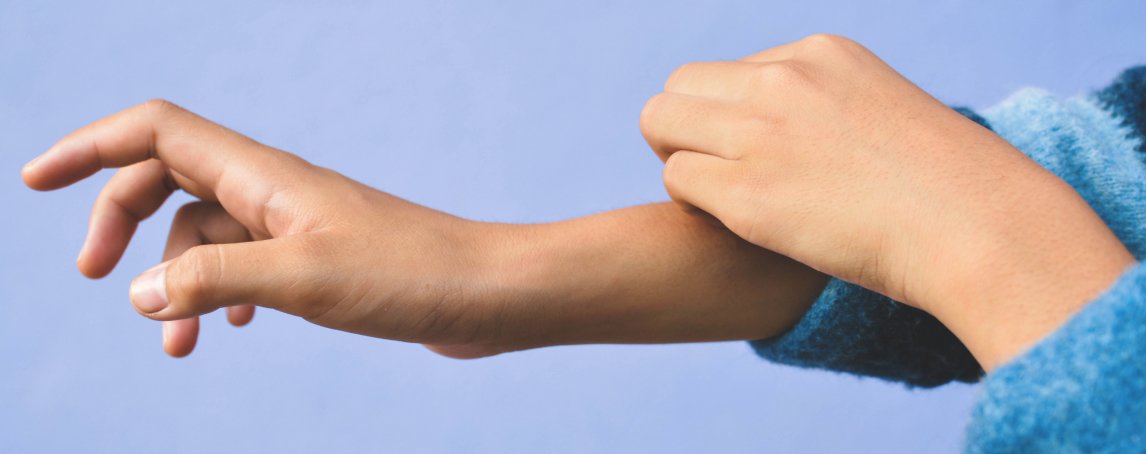 Conheça os sintomas do eczema e que cuidados ter para o prevenir