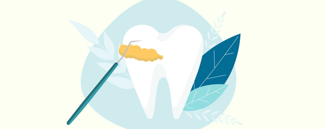 Tártaro: o que é e quais as suas consequências para a nossa higiene oral