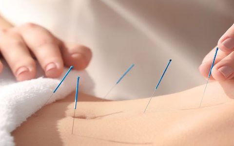 Acupuntura: 6 mitos esclarecidos por um especialista