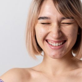 N&atilde;o rebente as borbulhas! Trate delas com pimple patches