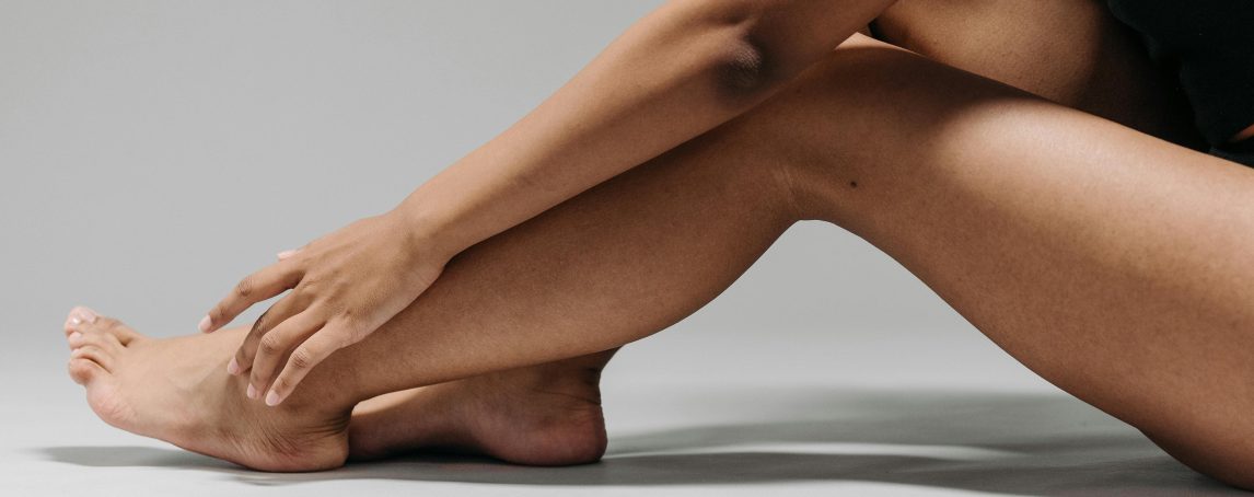 Lipedema: Sabe o que é a doença das 